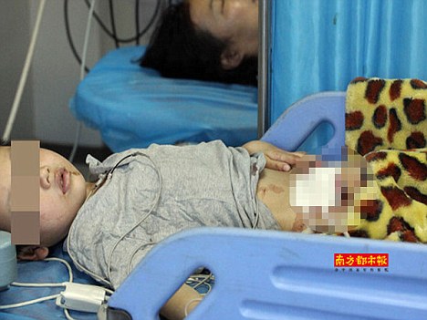 Furious father bites off six-year-old son’s penis in China before spitting it out