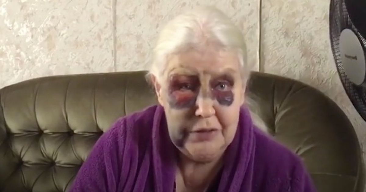 Pensioner, 79, bravely recalls being beaten and thrown to ground by evil thugs